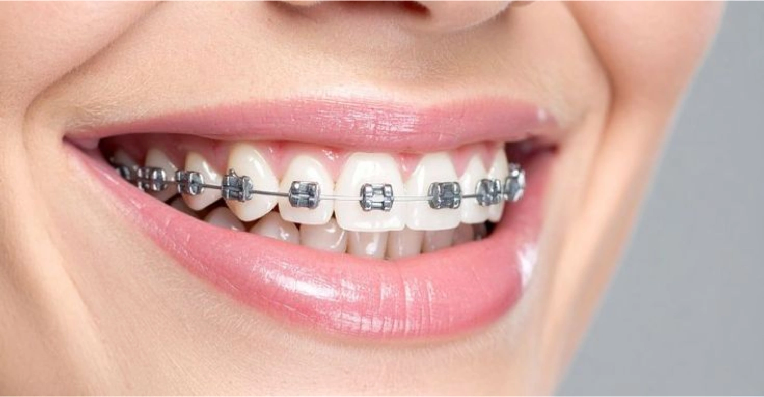 Orthodontics